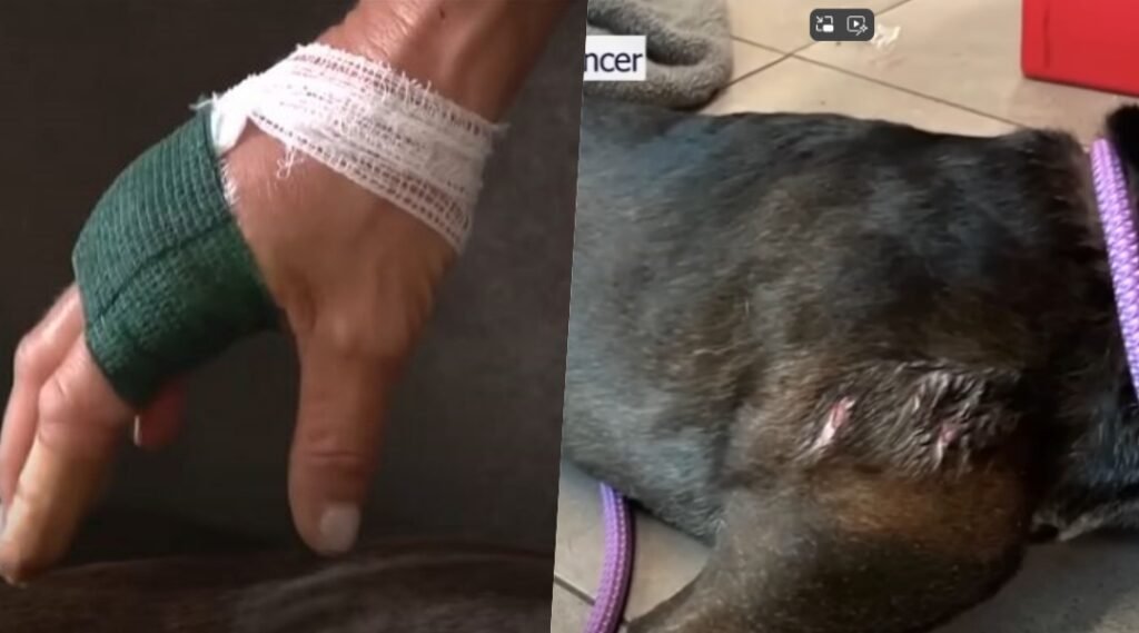 Spencer and her pup received stitches for their wounds.